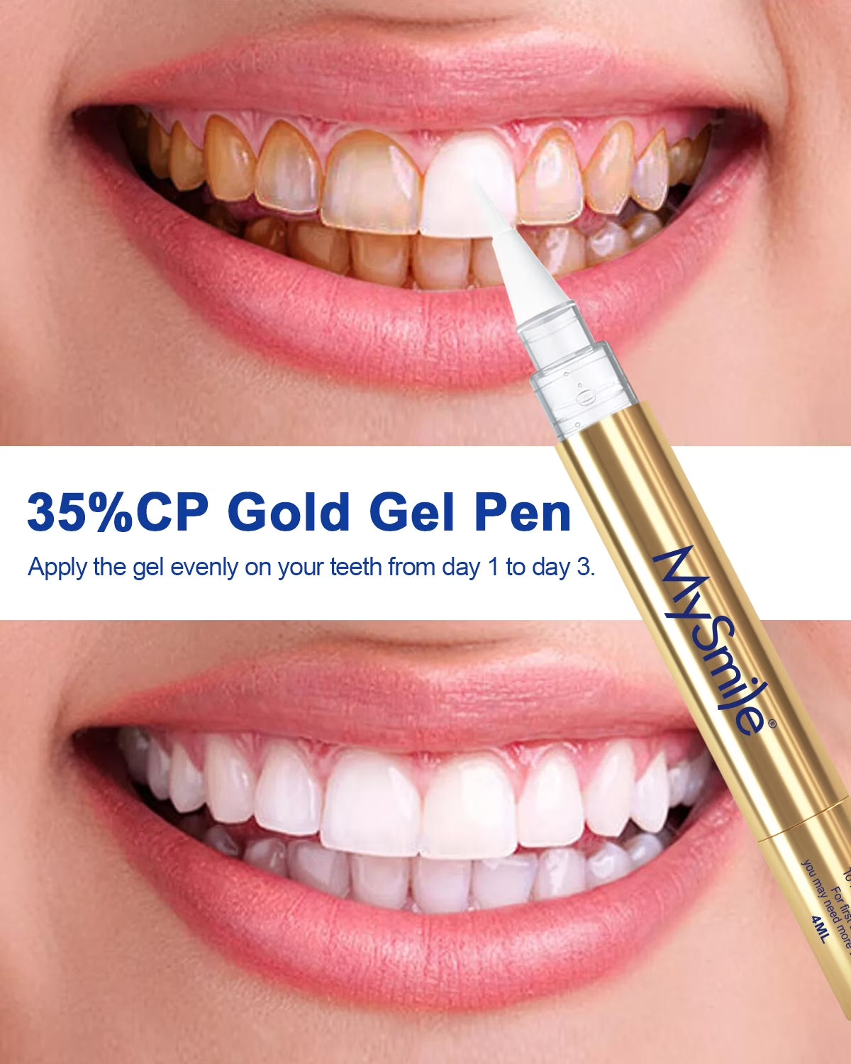 Premium 35%CP Teeth Whitening Pen, Teeth Whitening Kit, 2 X 4Ml Enhanced Formula Whitening Gel Refills (Gold), Enamel Safe, Remove 10 Years of Stains