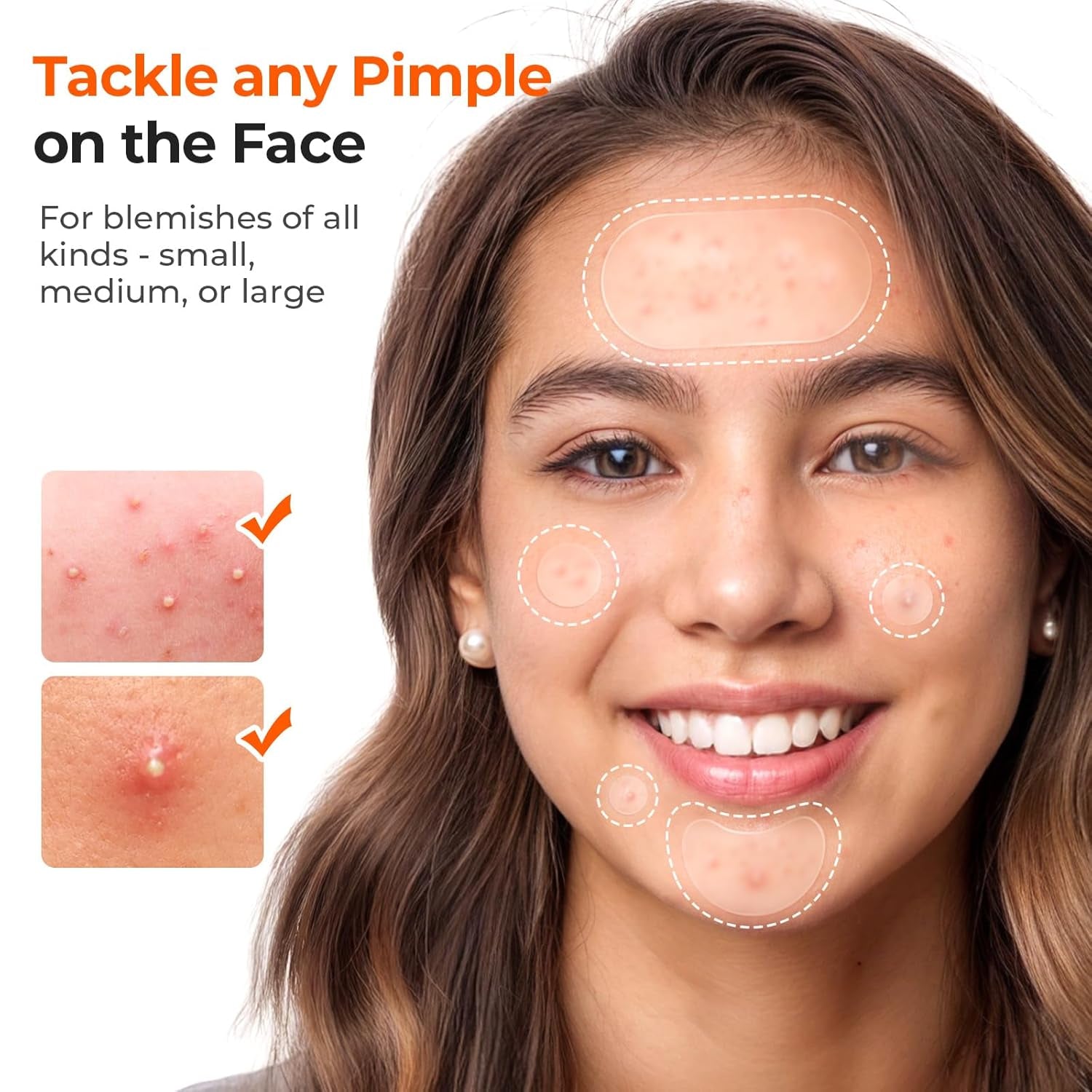 443 Count Pimple Patches for Face, Hydrocolloid Acne Patch Bulk, Acne Stickers for Covering Cheeks, Forehead, Chin Blemishes Zit Breakouts for All Skin Types (Dots, Strip, Contoured 5 Sizes)